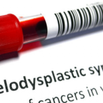 Sindromi-Mielodisplastiche-1170x585