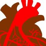 coronary-artery-diseas