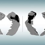 damage-early-in-alzhei