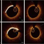 game-changing-new-ther