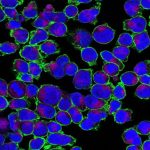 how-sugar-promotes-inf