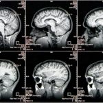 Multiple-CAT-Scan-Brain-Images-777x510