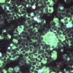 RSV CDC PHIL_3643_lores Craig Lyerla