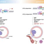 breast-cancer-why-meta