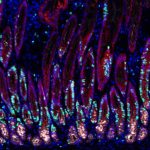 gastric-inflammation-h