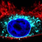 palmitoylation-a-new-t