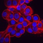 researchers-find-genet