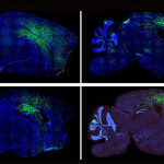 some-autism-spectrum-d