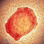 _103598601_m0501256-monkeypox_virus_particle_tem-spl