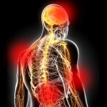 fibromialgia-meds-centro-clinico-sassari