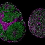 gene-therapy-reverses