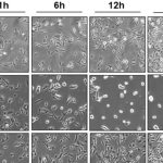peptide-delays-melanom
