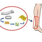 repairing-tendons-with