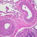 targeting-molecular-pa