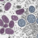 062422_EG-TI_monkeypox_feat-1030x580