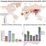 causes-of-liver-cancer-1