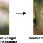 new-uci-led-study-reve