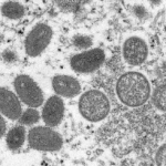 Monkeypox (1)