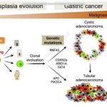 study-reveals-how-gast