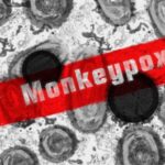 monkeypox-6
