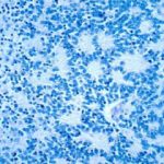 researchers-identify-a-1