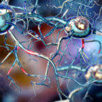 Affected Nerve cells, concept for Neurological Diseases,tumors,brain surgery.