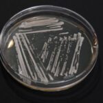 800px-Yeast_agar_plate-01-720x509