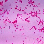 Fusobacterium_novum_01