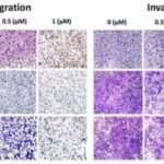 a-new-drug-target-for