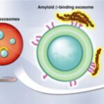 detecting-alzheimers-d-1