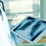 fibrosipolmonare
