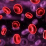 leucemia_ori_crop_MASTER__0x0