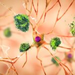 morbo-di-alzheimer-cause-orig (1)