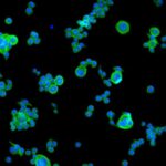 overcoming-resistance-1