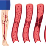 thinkstockphotos-542696628_thumb_720_480