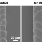 110922AlopeciaNanozymeHR-scaled