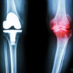 Fotolia_69885340_Subscription_Monthly_M