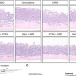 research-identifies-ne