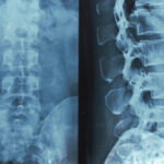 thinkstockphotos-628307082_thumb_720_480 (1)