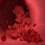blood-vessel-1