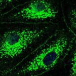cystic-fibrosis-drug-c