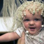 gene-therapy-offers-ho-1