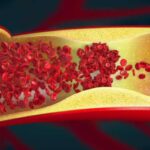 transdifferentiation-g