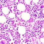 study-reveals-how-chro