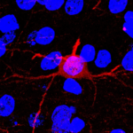 Low-Res_HDAC5 WT Psuedocolor.jpg