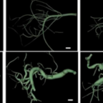 Low-Res_LRP1 arteries.png