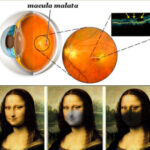 degenerazione_maculare01 (1)