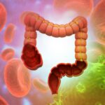 tumore-colon-retto-test