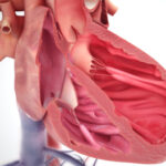 0230-insufficienza-cardiaca-avanzata