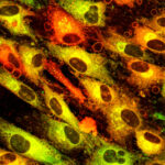 _20230317_nf_ceramides-skin
